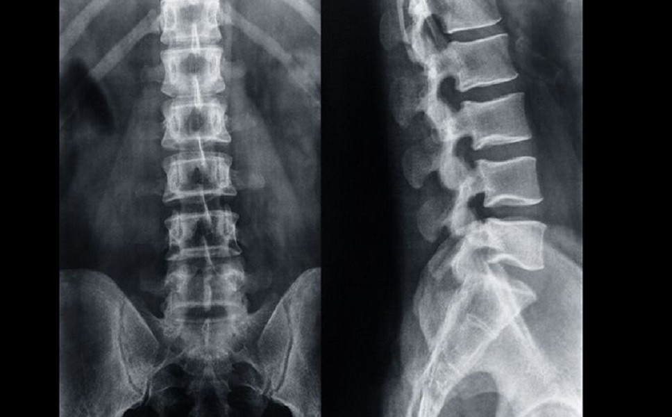 colonna vertebrale.jpg